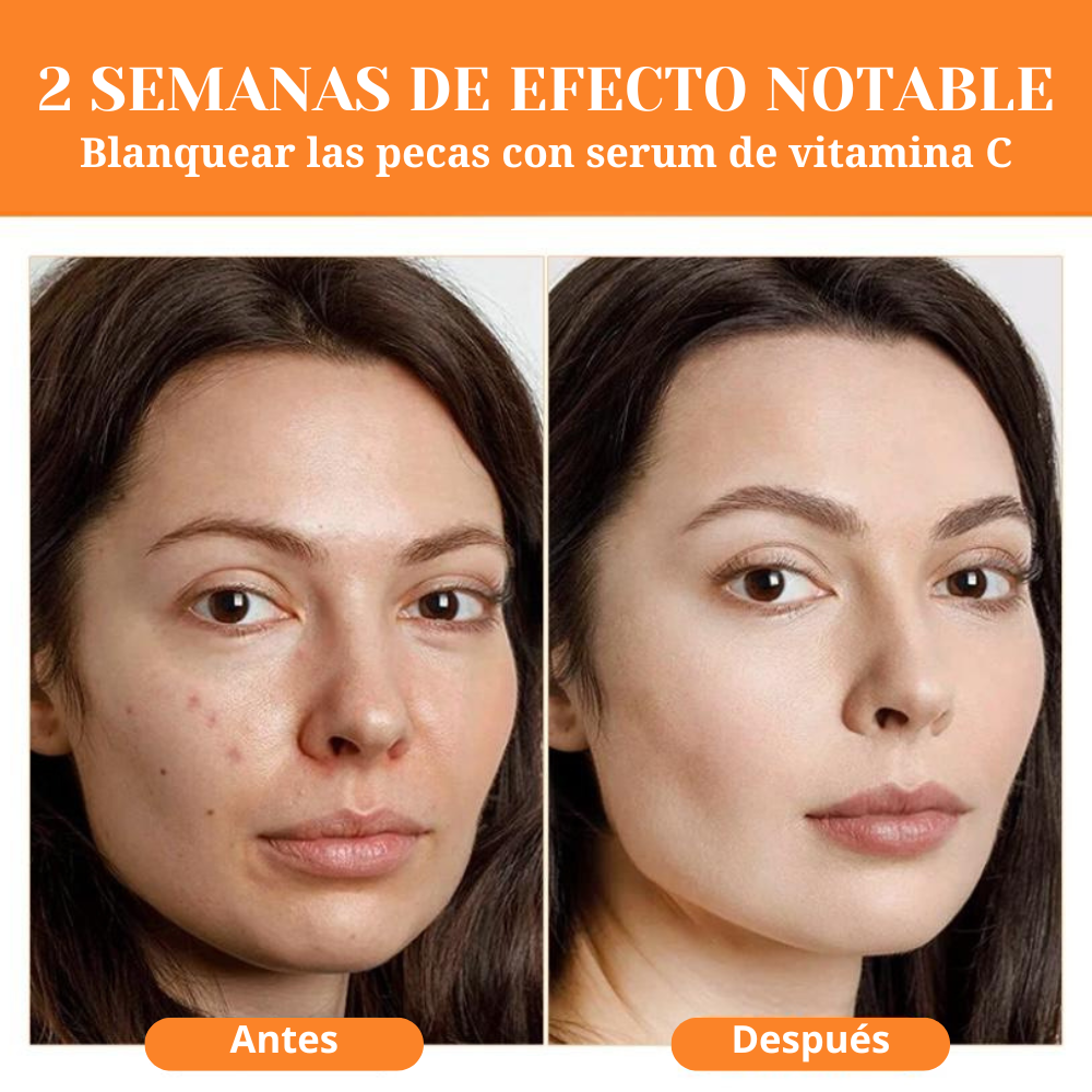 Serum de vitamina C