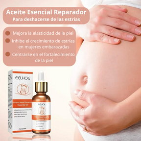 Aceite esencial reparador de estrías